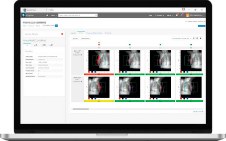 1393 03 Adaptivo BR In Vivo