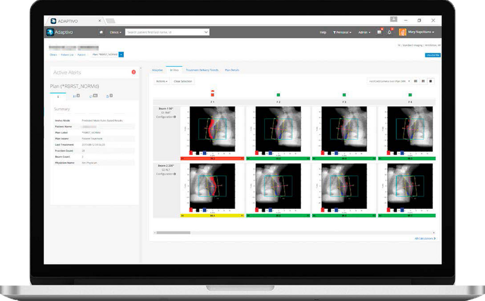 1393 03 Adaptivo BR In Vivo